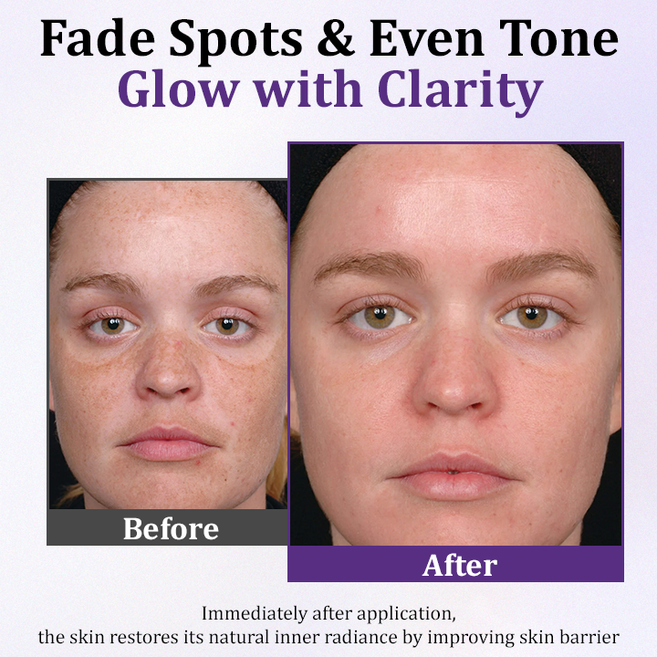 Seurico™ PigmentaX ProFade Anti-Hyperpigmentation Cream ✨🌿