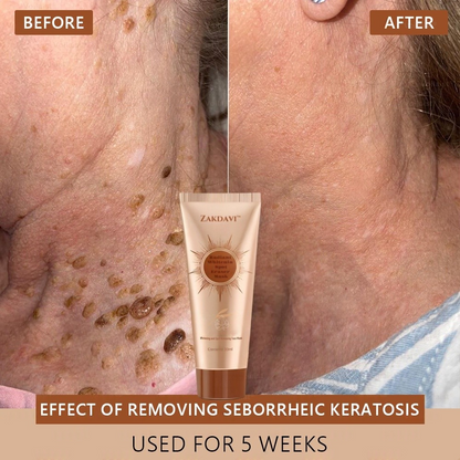 🏵️ Zakdavi™ Radiant Whitening & Spot Eraser Mask✨| For Face and Body - Formulated with natural ingredients to permanently eliminate age spots, freckles, sun spots, and liver spots.