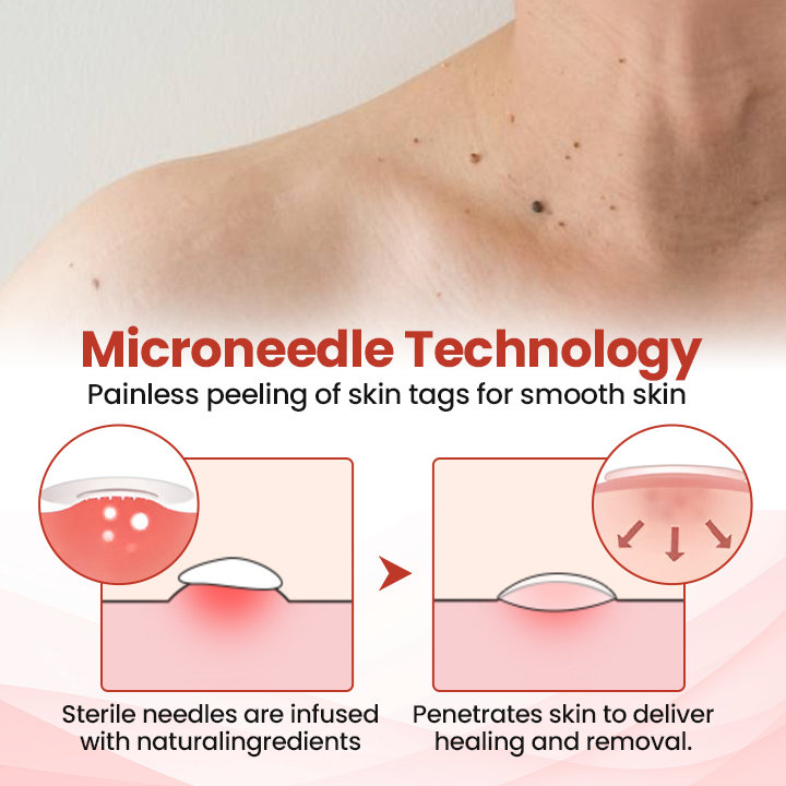 Odeiun™ TagDrop Painless Micro Patch