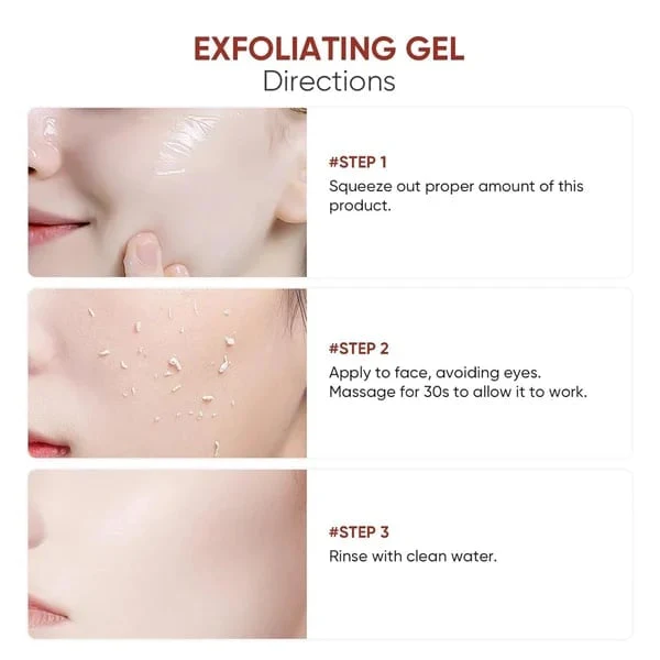 Negusy™ Purifying Exfoliating Gel for Acanthosis Nigricans, Exfoliation, Dark Spots, Skin Tags, Eczema