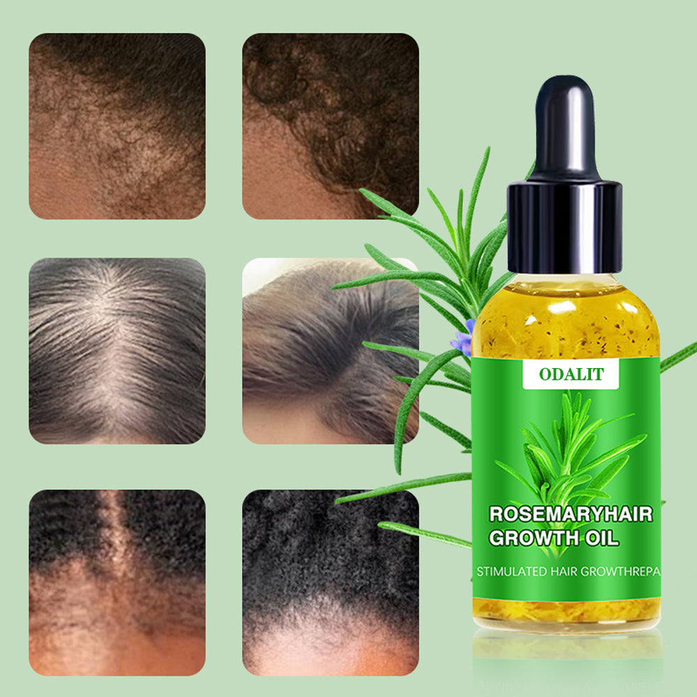 ODALIT™ Hair Growth Serum 🌱(AAD recommended)