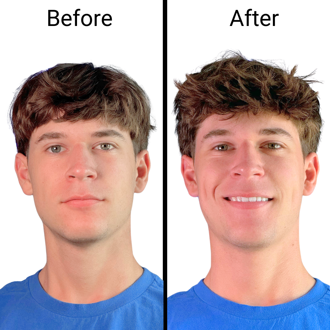 Negusy™ Hair Styling Powder – Instant volume, lasting confidence!