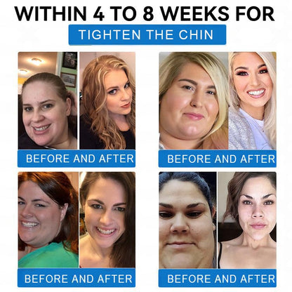 ✅ Best Seller-LBMLBM® 𝐓𝐢𝐫𝐳𝐞𝐩𝐚𝐭𝐢𝐝𝐞 & 𝐂𝐨𝐥𝐥𝐚𝐠𝐞𝐧 𝐍𝐚𝐧𝐨 𝐌𝐢𝐜𝐫𝐨𝐧𝐞𝐞𝐝𝐥𝐞 𝐖𝐞𝐢𝐠𝐡𝐭 𝐋𝐨𝐬𝐬 𝐏𝐚𝐭𝐜𝐡丨Targets Obesity, Loose Skin, High Blood Pressure, Diabetes, Fatty Liver, Joint Pain, Brain Fog, Low Energy, Body Aches, and More