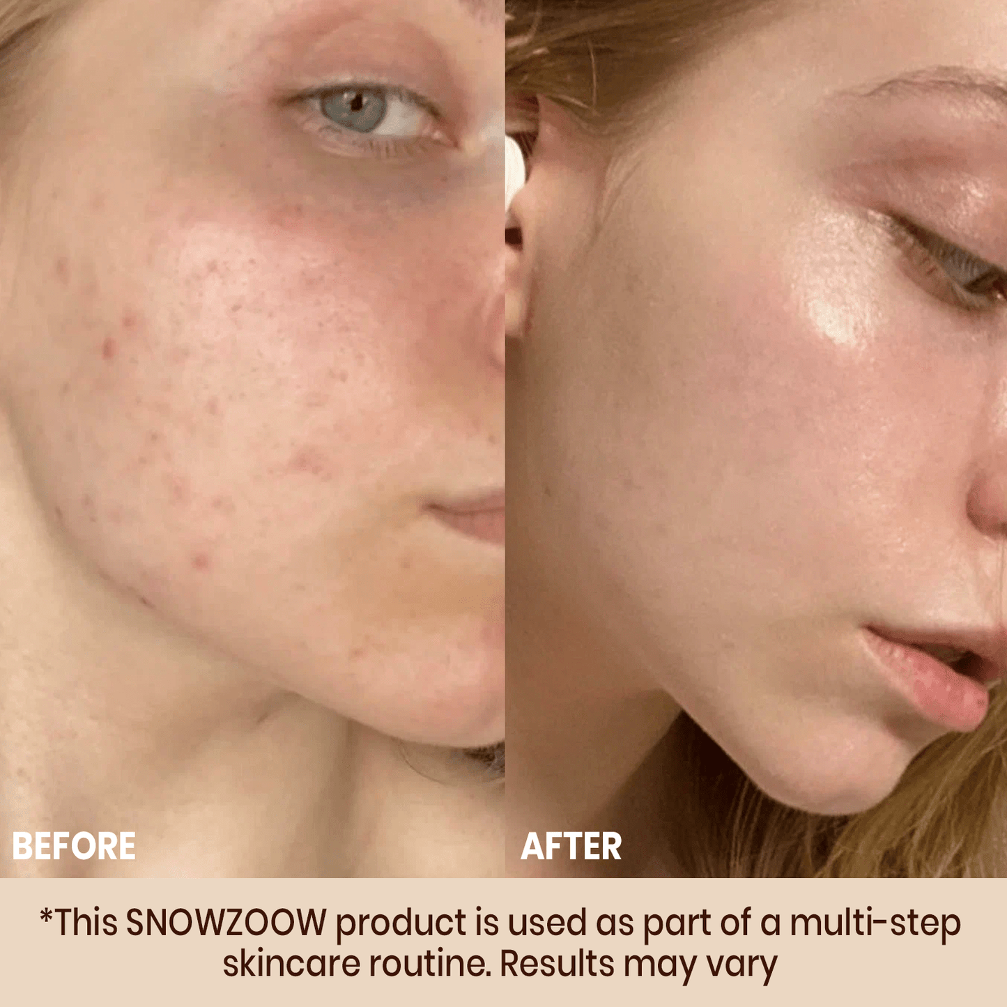 Odeiun™ Radiance Foundation ACE 1 🌟 | Luxury in a Bottle, Beauty You Deserve