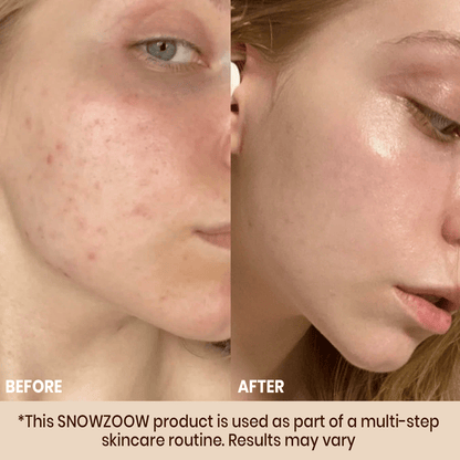 Odeiun™ Radiance Foundation ACE 1 🌟 | Luxury in a Bottle, Beauty You Deserve