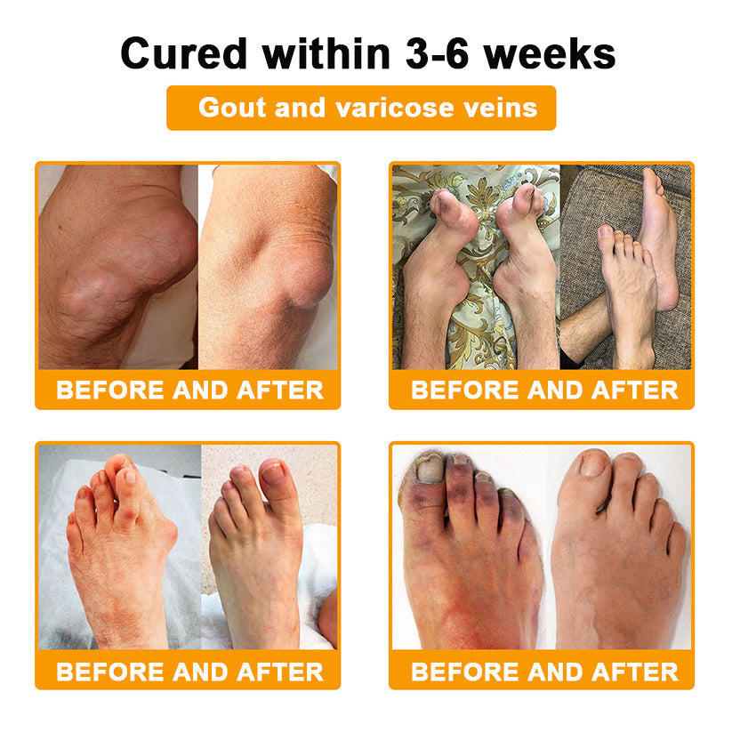 🎁Flash Sale - Odeiun™ Botulinum Toxin & Bee Venom Pain-Relief Bone Healing Cream