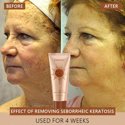 🏵️ Zakdavi™ Radiant Whitening & Spot Eraser Mask✨| For Face and Body - Formulated with natural ingredients to permanently eliminate age spots, freckles, sun spots, and liver spots.