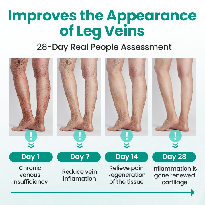 🩺 RELIEVEIN® Advanced Varicose Veins Patch: Clinical-Strength Vein Repair & Swelling Relief  🦵