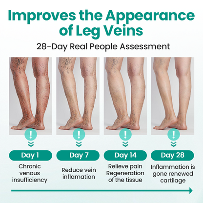 🩺 RELIEVEIN® Advanced Varicose Veins Patch: Clinical-Strength Vein Repair & Swelling Relief  🦵