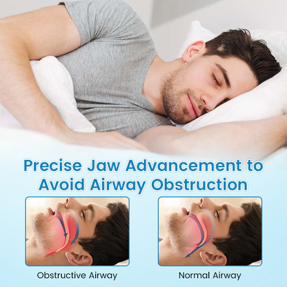✨Negusy™ Anti-Snoring & Anti-Grinding Teeth Protector