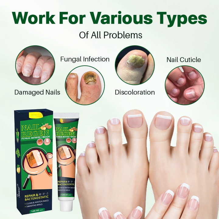 NailRegen Fungal Remedy Cream