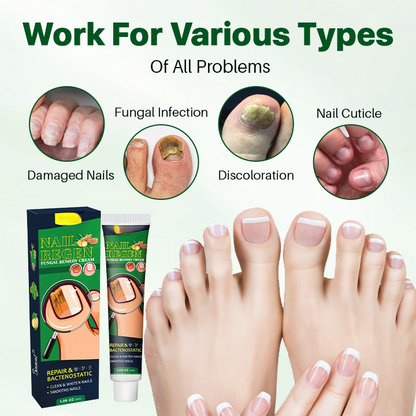 NailRegen Fungal Remedy Cream