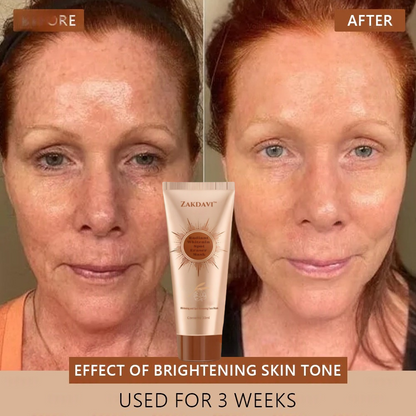🏵️ Zakdavi™ Radiant Whitening & Spot Eraser Mask✨| For Face and Body - Formulated with natural ingredients to permanently eliminate age spots, freckles, sun spots, and liver spots.