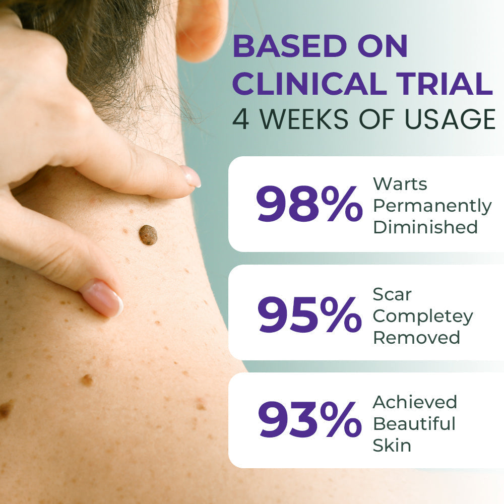 Seurico™ New NatureVanish Mole & Dark Spot Removal Bio-Gel