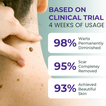 Seurico™ New NatureVanish Mole & Dark Spot Removal Bio-Gel