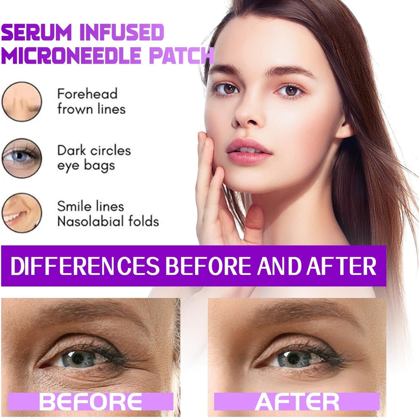 Seurico™ MicroGlow Patches