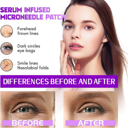 Seurico™ MicroGlow Patches