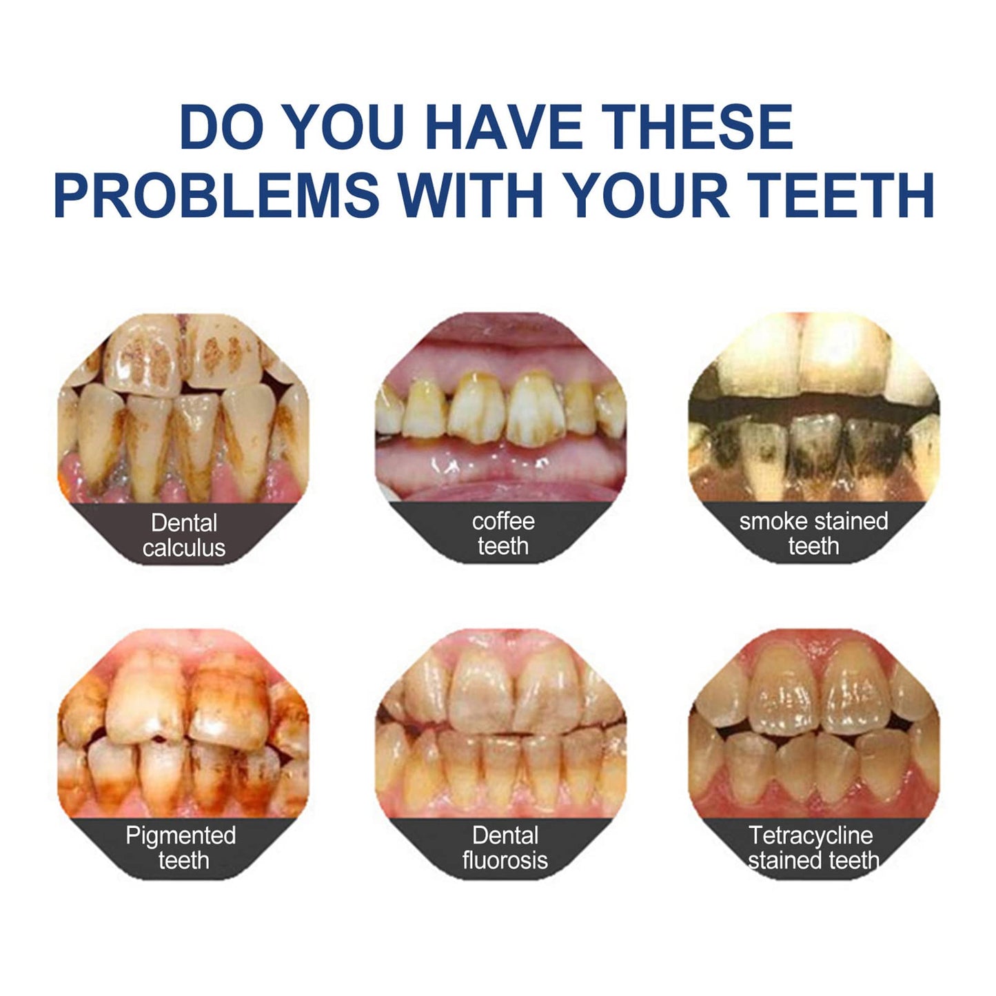 🛡️ Odalt™: Rebuild & Restore Your Smile with Hydroxyapatite