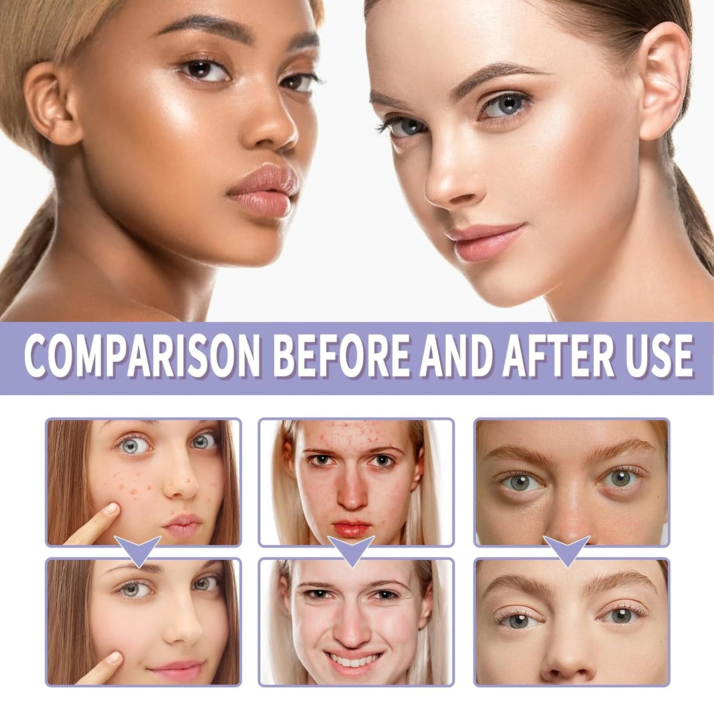 Negusy™ Soft Matte Cream Concealer