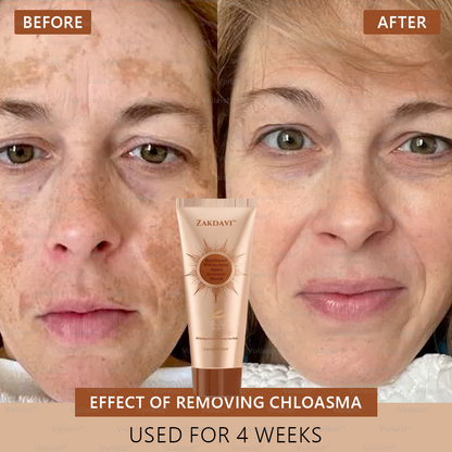 🏵️ Zakdavi™ Radiant Whitening & Spot Eraser Mask✨| For Face and Body - Formulated with natural ingredients to permanently eliminate age spots, freckles, sun spots, and liver spots.