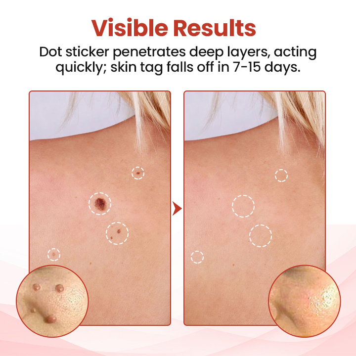 Odeiun™ TagDrop Painless Micro Patch