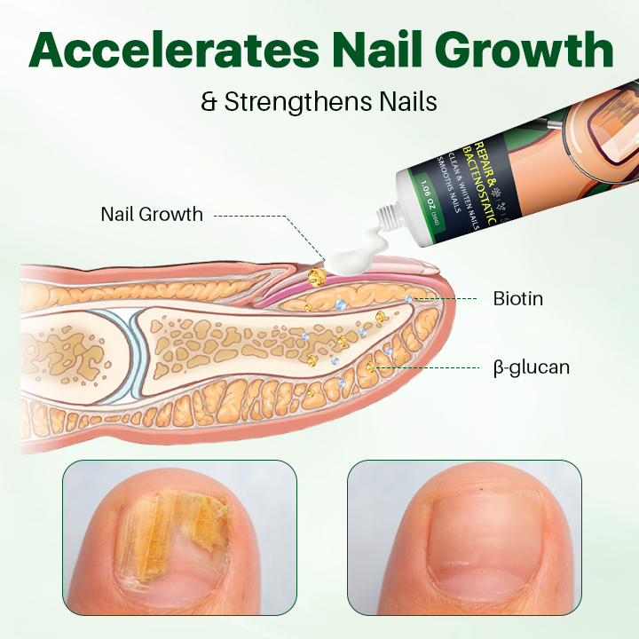 NailRegen Fungal Remedy Cream