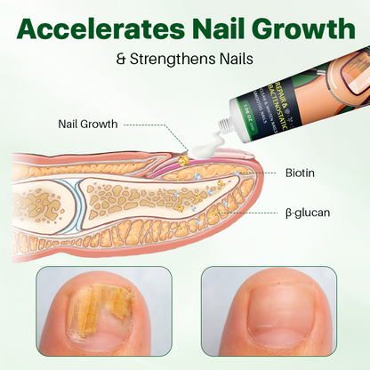 NailRegen Fungal Remedy Cream