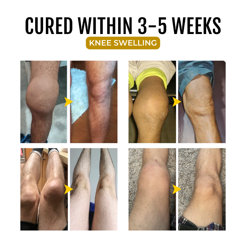 🔥Seurico™ Emu Oil Gel 🧊 Refuse pain and inflammation