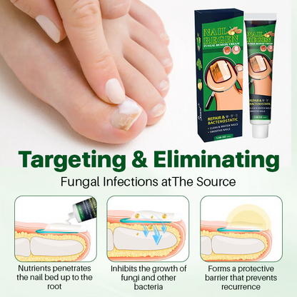 NailRegen Fungal Remedy Cream