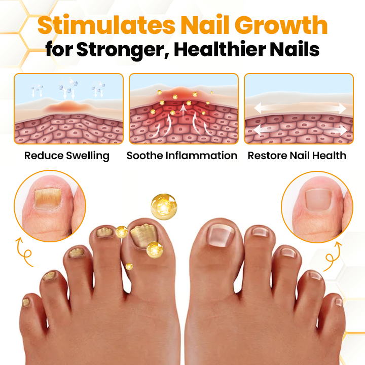 Seurico™ BeeVenom Anti-Fungal Nail Renewal Oil