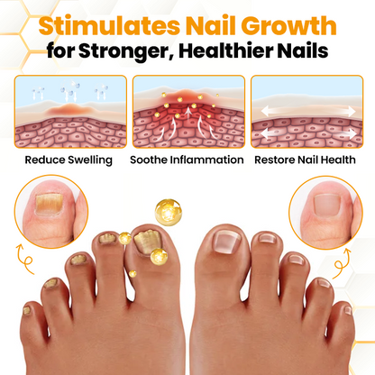 Seurico™ BeeVenom Anti-Fungal Nail Renewal Oil