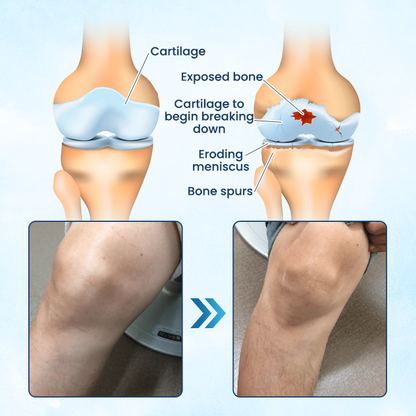 Negusy™ Joint Revive Hyaluronic Repair Cream