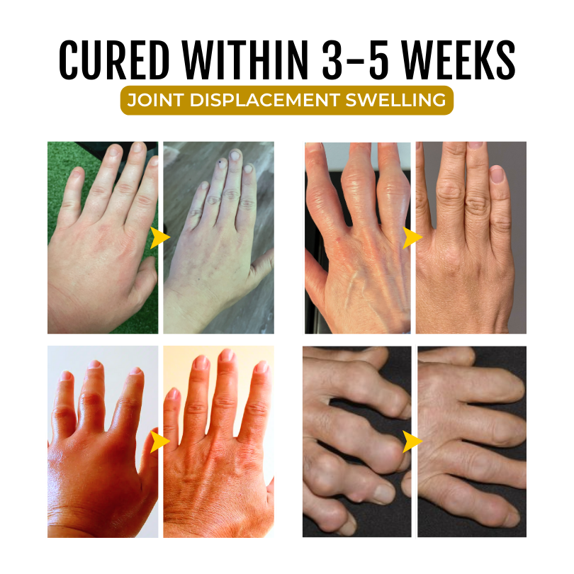 🔥Seurico™ Emu Oil Gel 🧊 Refuse pain and inflammation