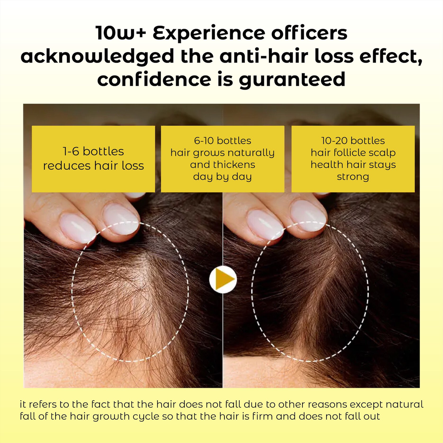 Odeiun™ Natural Hair Density Growth Essential Oil