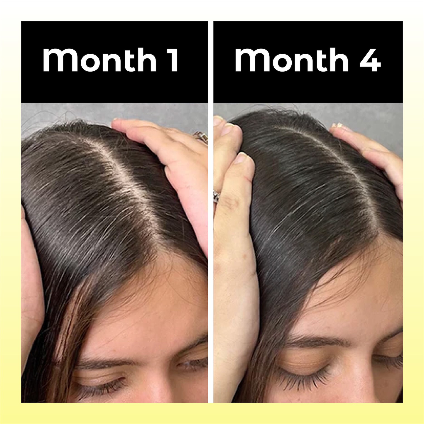 Odeiun™ Natural Hair Density Growth Essential Oil