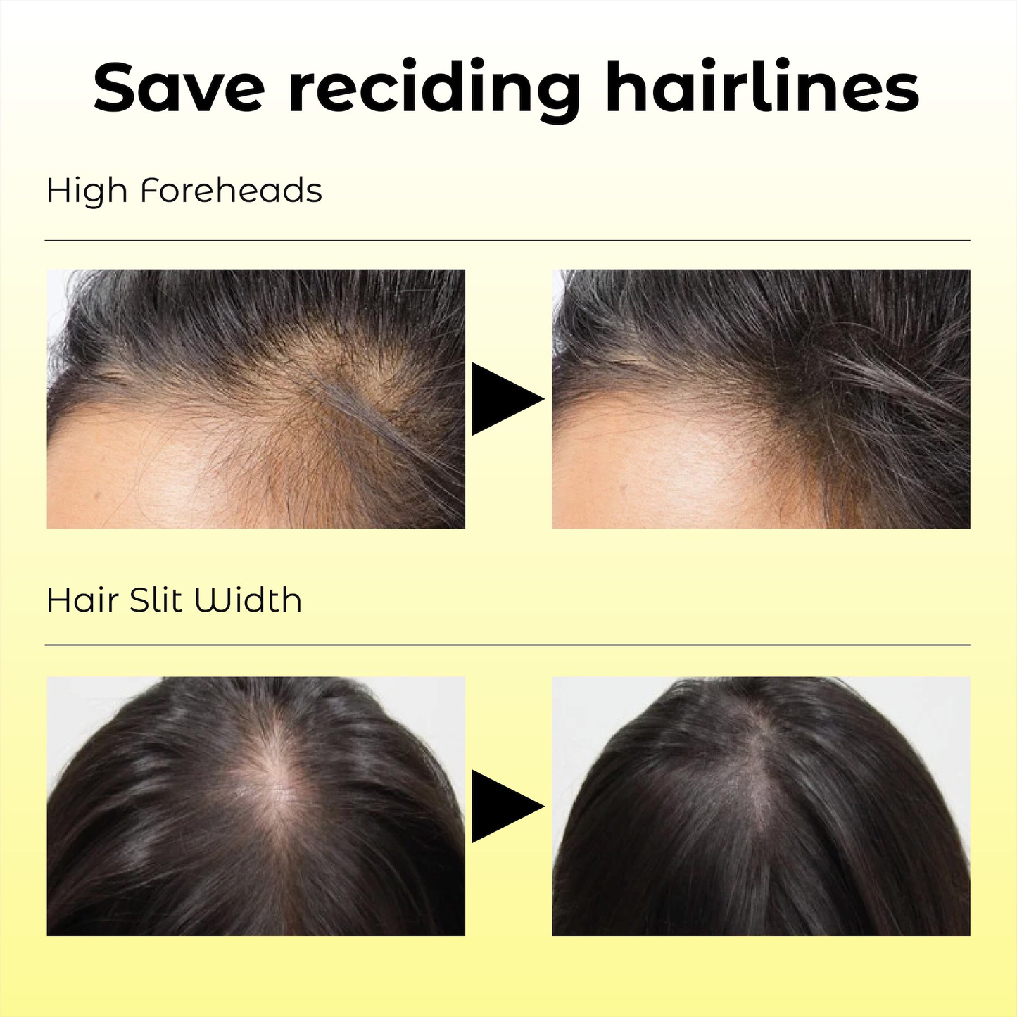 Odeiun™ Natural Hair Density Growth Essential Oil