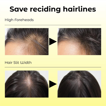 Odeiun™ Natural Hair Density Growth Essential Oil