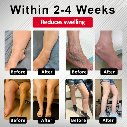 ODEIUN™ Advanced CVI Edema Therapy Cream