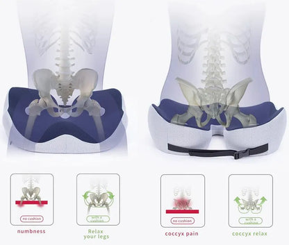 Zakdavi™ Orthopedic Ventilated Memory Foam Seat Cushion – Relieve Pressure & Sit in Comfort All Day