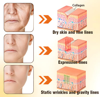 ✅ Official Store | ODEIUN™ Anti-Aging Moisturizing Cream 💧 Hyaluronic Acid + Retinol + Collagen – Youthful Glow for Face, Neck, Chest & Legs ✨ Day & Night Care