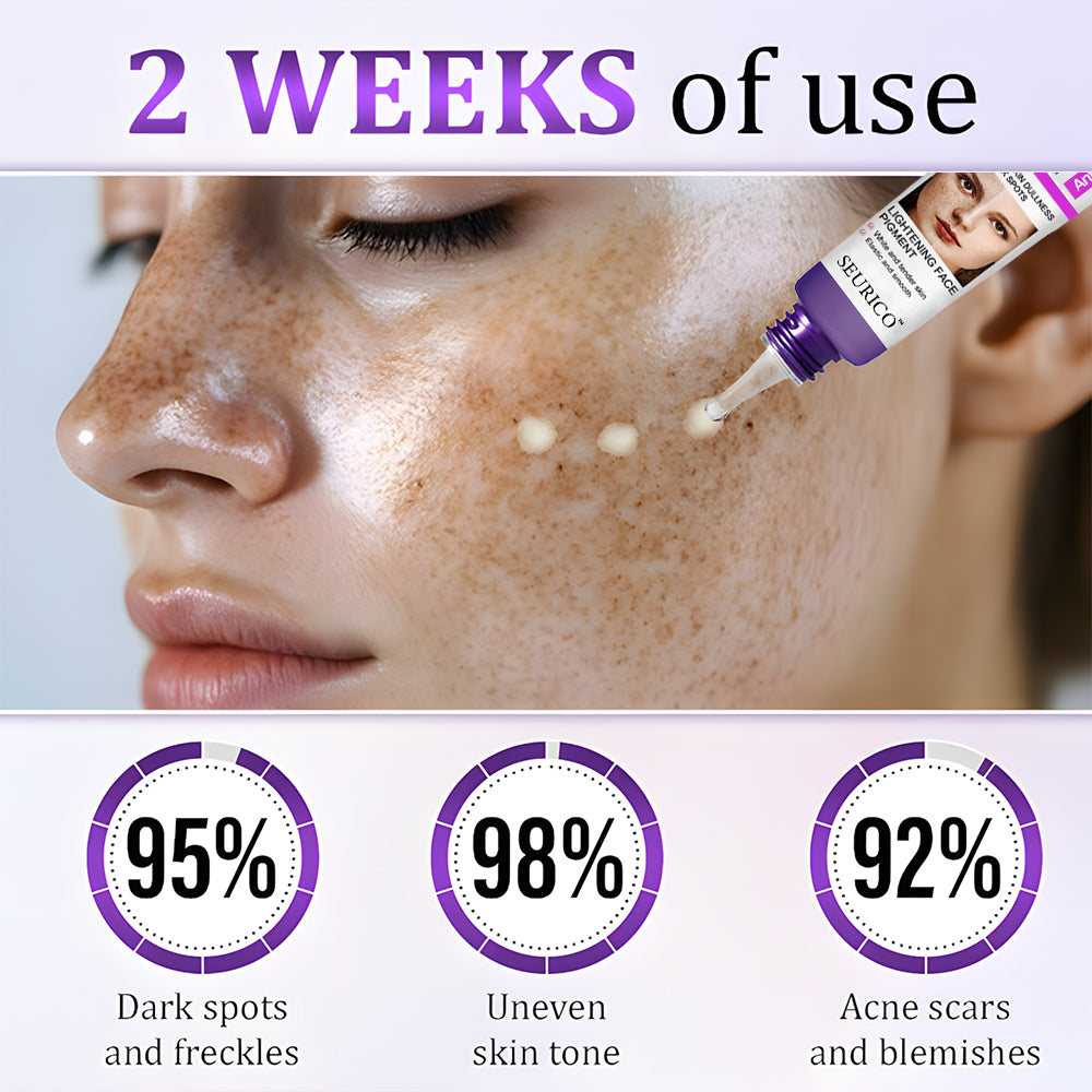 Seurico™ PigmentaX ProFade Anti-Hyperpigmentation Cream ✨🌿