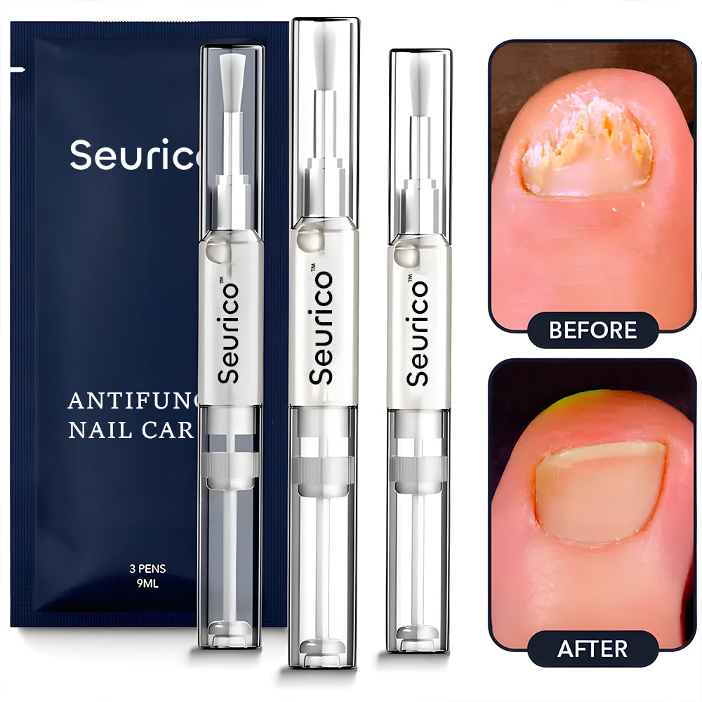 Seurico™ Antifungal Pen – Fast, Natural Relief for Clearer, Healthier Nails