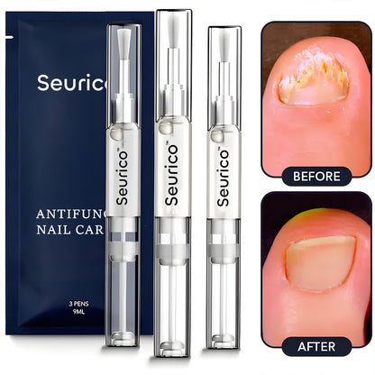 Seurico™ Antifungal Pen – Fast, Natural Relief for Clearer, Healthier Nails