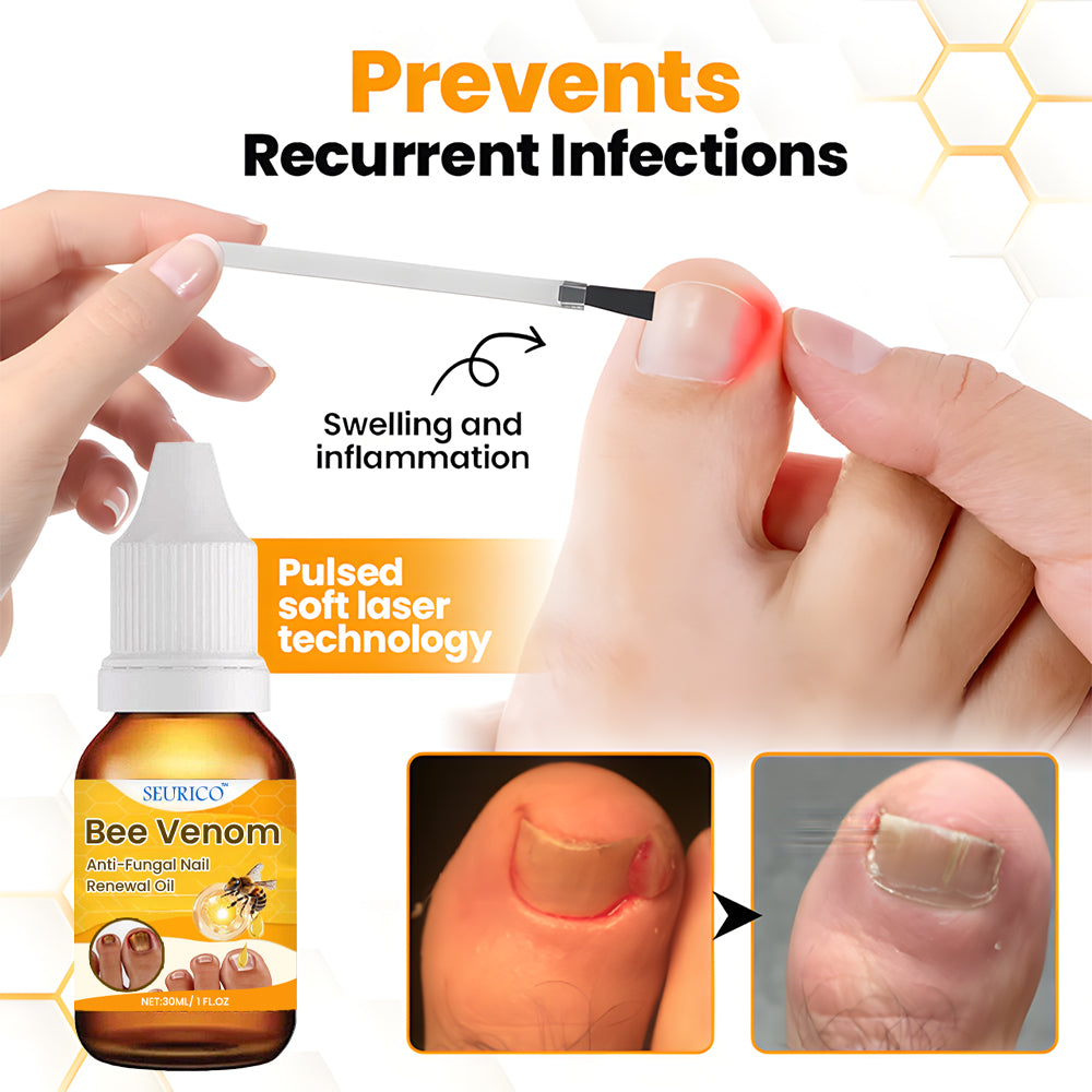 Seurico™ BeeVenom Anti-Fungal Nail Renewal Oil