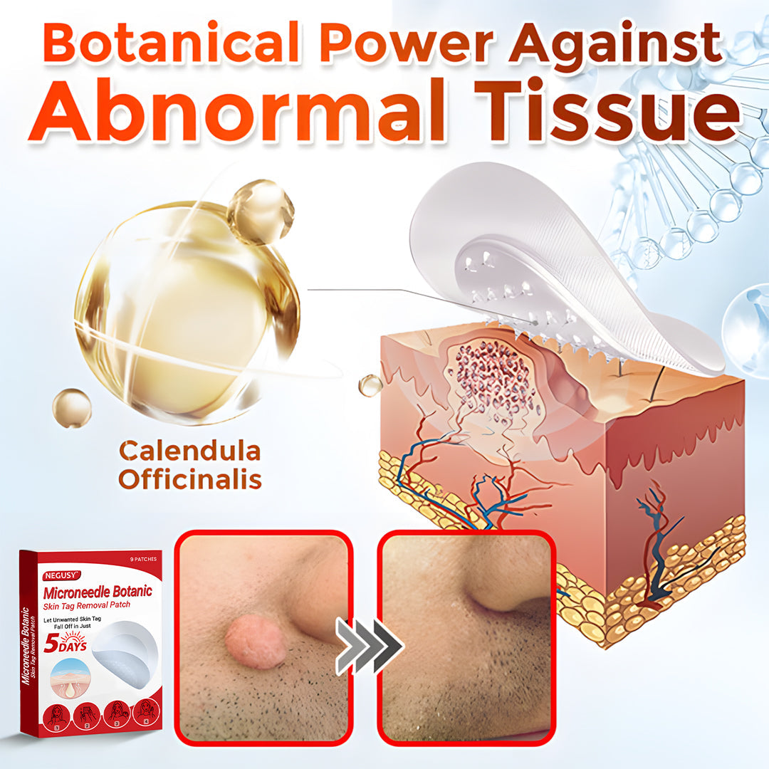 ✨Limited Time Discount🌿 Negusy™ MicroNeedle Skin Tag Remover Patch – Plant-Based & Painless