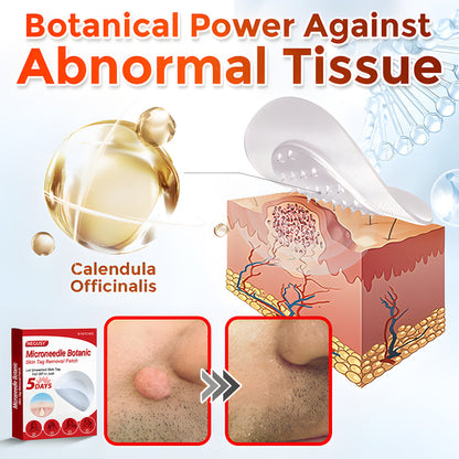 ✨Limited Time Discount🌿 Negusy™ MicroNeedle Skin Tag Remover Patch – Plant-Based & Painless