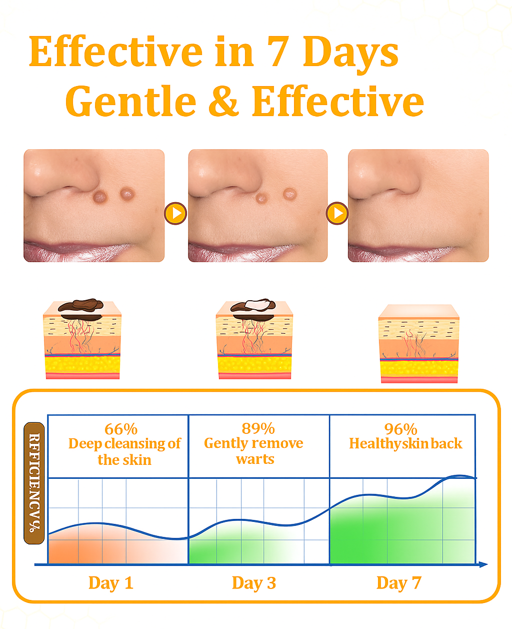 ✨ ODEIUN™ BeeDerm RX Cream – Natural Wart, Mole & Skin Tag Remover with Healing Bee Venom