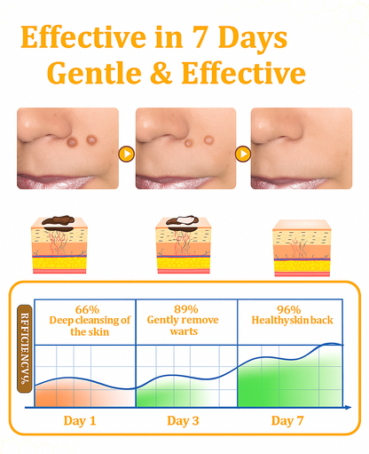 ✨ ODEIUN™ BeeDerm RX Cream – Natural Wart, Mole & Skin Tag Remover with Healing Bee Venom