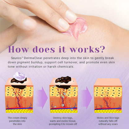 Seurico™ DermaClear Mole and Dark Spot Removal Bio-Gel