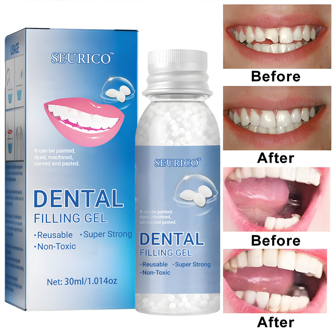 🦷 Seurico™ Dental Filling Gel – Pain-Free, Drill-Free Cavity Solution💖💖